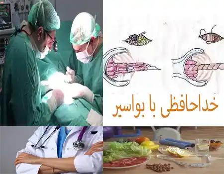 خداحافظی با بواسیر در کلینیک تهران